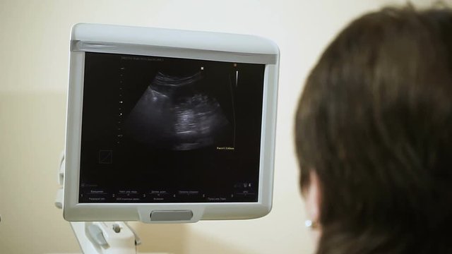 Female doctor examining the woman's kidneys using an ultrasound scanner. HD