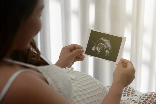Young pregnant woman looking at ultrasound scan of baby