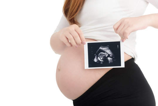 Pregnant woman holding ultrasound scan isolated on white background.