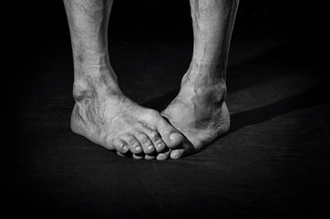 Dirty bare feet.