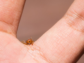 Closeup red ant bite man hand