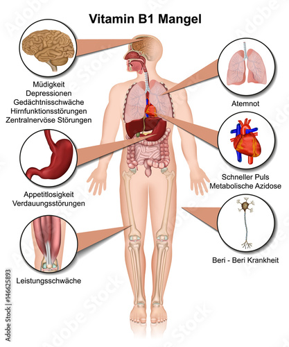 metabolische azidose symptome