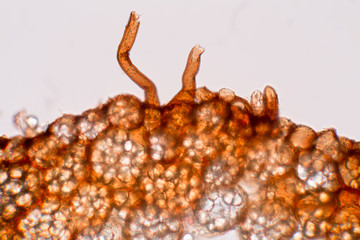 Root of Drosera under the microscope for education in laboratory.