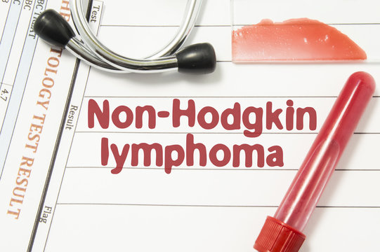 Diagnosis Of Non-Hodgkin Lymphoma. Laboratory Blood Bottle, Glass Slide With Blood Smear, Hematology Test, Stethoscope Lying On Note With Printed Text Hematological Diagnosis Of Non Hodgkin Lymphoma 