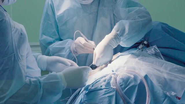 Surgical operation of the abdomen