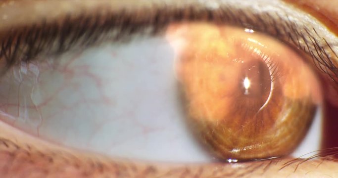 Closeup eye with reflection nuclear explosion and fire. Macro shot on RED 4K.