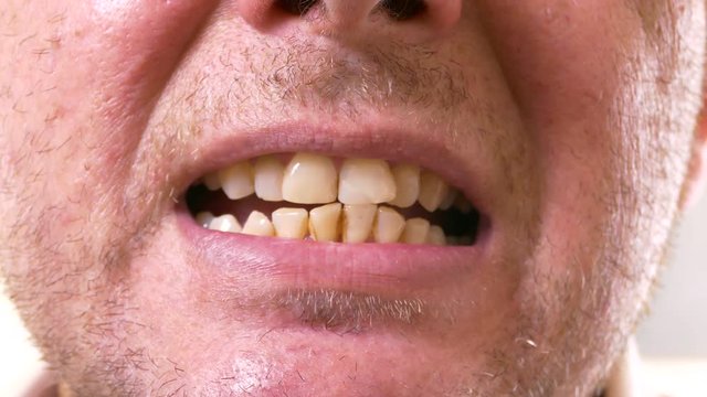 Closeup of man showing yellow teeth