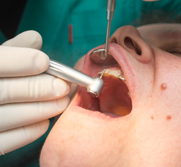 The dentist works with the client in the clinic