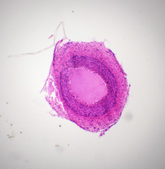 Artery section under the microscope