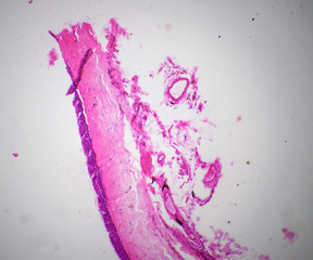 Ciliatde epithelium section under the microscope