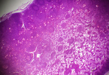 Lymph node section under the microscope