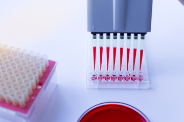 Blood test and experimental research analysis in laboratory.