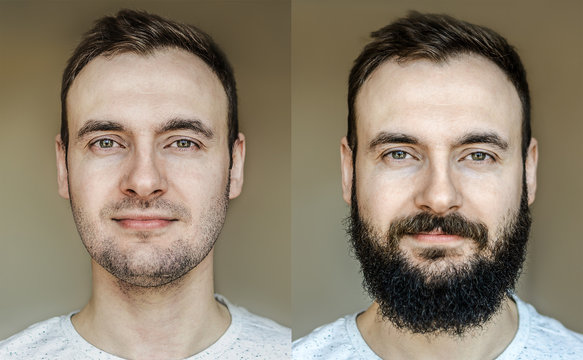 A collage of a beautiful portrait of a man with a full beard and no beard after shaving with light stubble. Barber working on a brown background.