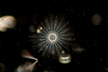 Chaetoceros (Diatom) under microscope view.