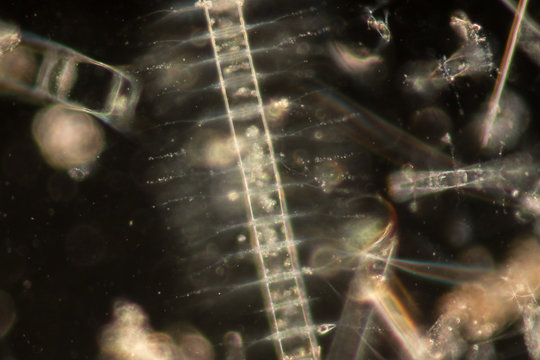 Chaetoceros (Diatom) Under Microscope View.