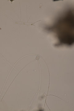 Chaetoceros (Diatom) Under Microscope View.