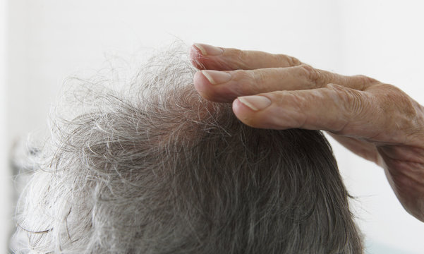 Senior man touching bald spot