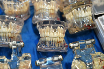 Tooth implant prosthesis
