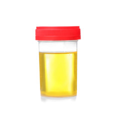 Medical urine test in plastic container on white background