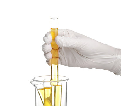 Hand in glove taking test tube with urine from beaker on white background