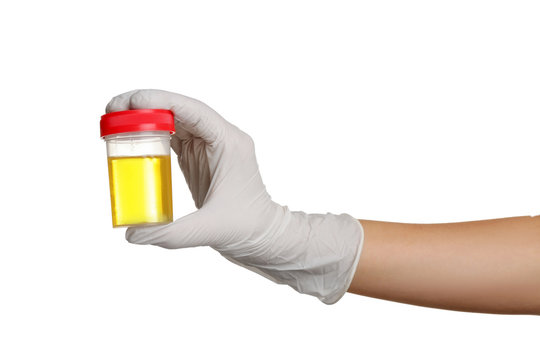 Hand in white glove holding specimen cup with urine test on white background