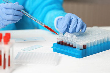 Scientist working with blood samples in laboratory