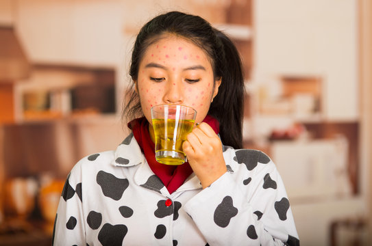 Portrait of young girl with skin problem drinking some tea