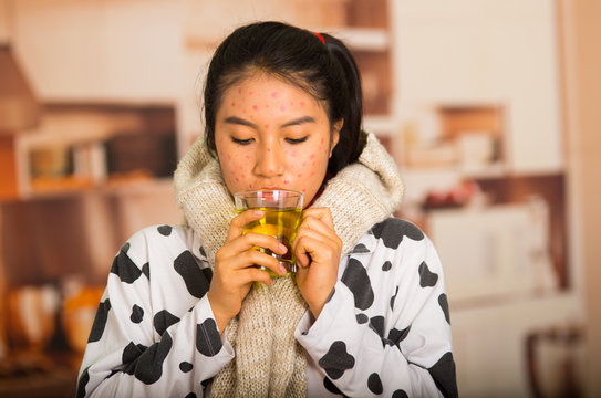 Portrait of young girl with skin problem drinking a cup of te with a grey towel around her neck
