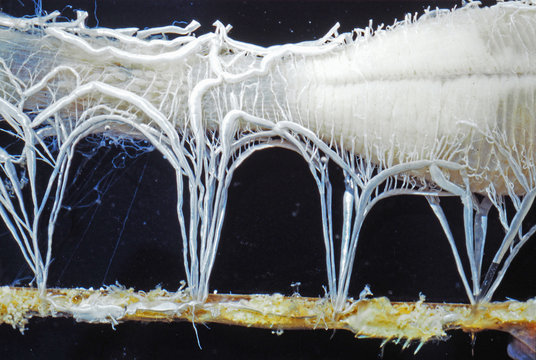 Dissection abdomen de phasme (tube digestif, trach&eacute;es, stigmates)