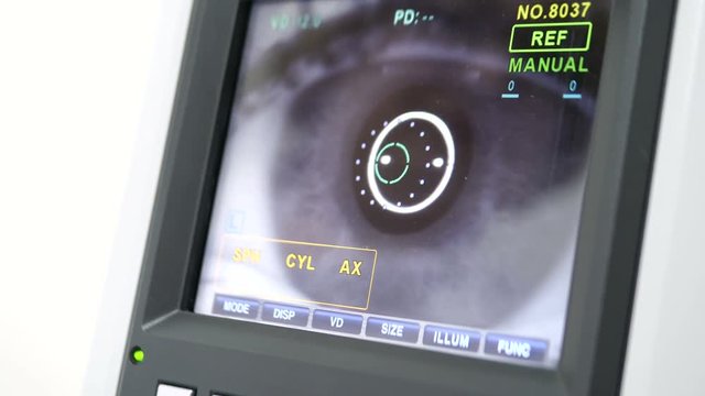 Keratometer - Modern Automated Machine Examining Eyeball