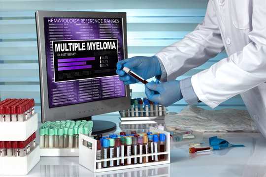 Doctor In Lab Examining Blood Sample With The Text Multiple Myeloma In Screen Of Computer / Technician With Blood Sample And Text Multiple Myeloma In The Software Of Analysis Laboratory