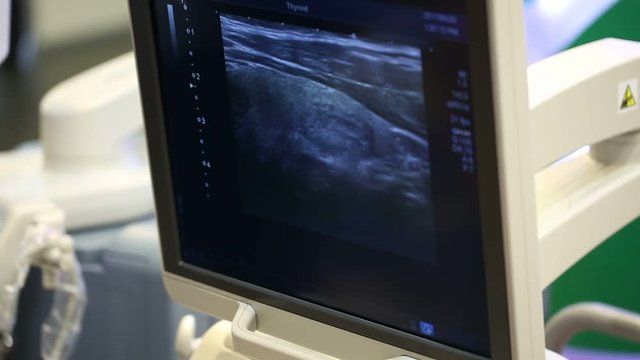 Ultrasound