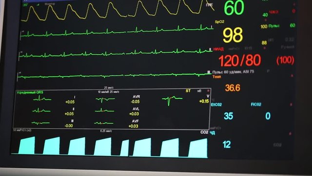 Heart Rate and Pressure Monitor