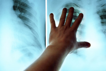 hand of man holding x-ray films during examinating them, close up