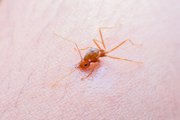 Ant biting human skin