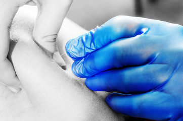 Needle and hands of physiotherapist doing a dry needling in silhouette studio on white background.