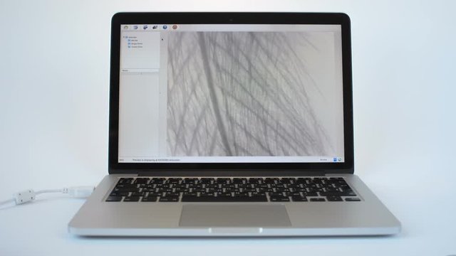 Scientist Exmining a Feather on Laptop Monitor Magnified through Digital Microscope