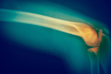 Close up  bone  x-ray