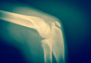 Close up  bone  x-ray