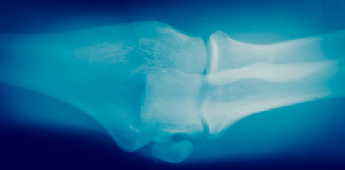 Close up  bone  x-ray