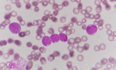 blood smear is often used as a follow-up test