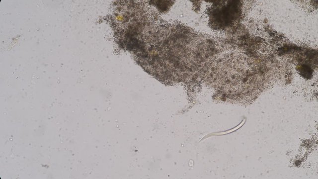 Moment of Strongyloides stercoralis (threadworm) in stool, analyze by microscope 