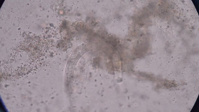 Moment of Strongyloides stercoralis (threadworm) in stool, analyze by microscope 