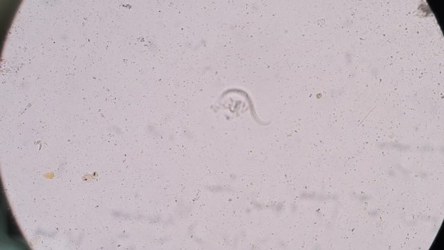 Moment of Strongyloides stercoralis (threadworm) in stool, analyze by microscope 