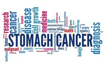 Stomach cancer