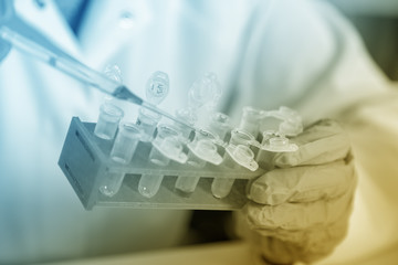 Pipette adding fluid to one of several test tubes .medical glassware