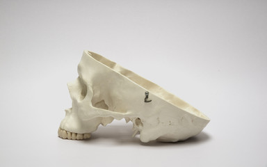 Artificial human skull model