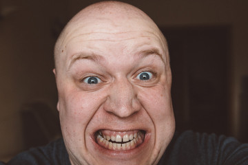 Scary expression with bulging eyes and bald head