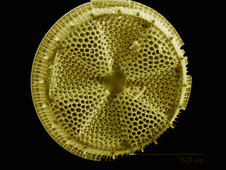 The test of a diatom imaged in a scanning electron microscope