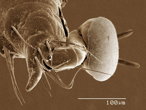 Tarsus of a dog tick (Acari: Dermacentor sp.) imaged in a scanning electron microscope